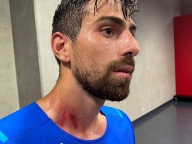 【博狗体育】马赛3名球员在球迷骚乱中受伤 伤痕清晰可见(图)