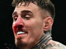 大发体育-UFC冠军汤姆将继续进行双眼手术,大发助力你的致富之路!